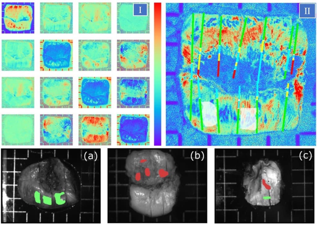 Reading Tissue Microstructure