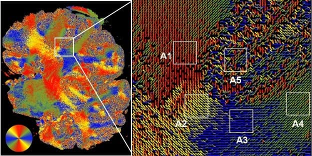 Azimuth of the optical axis map of a formalin-fixed human brain section