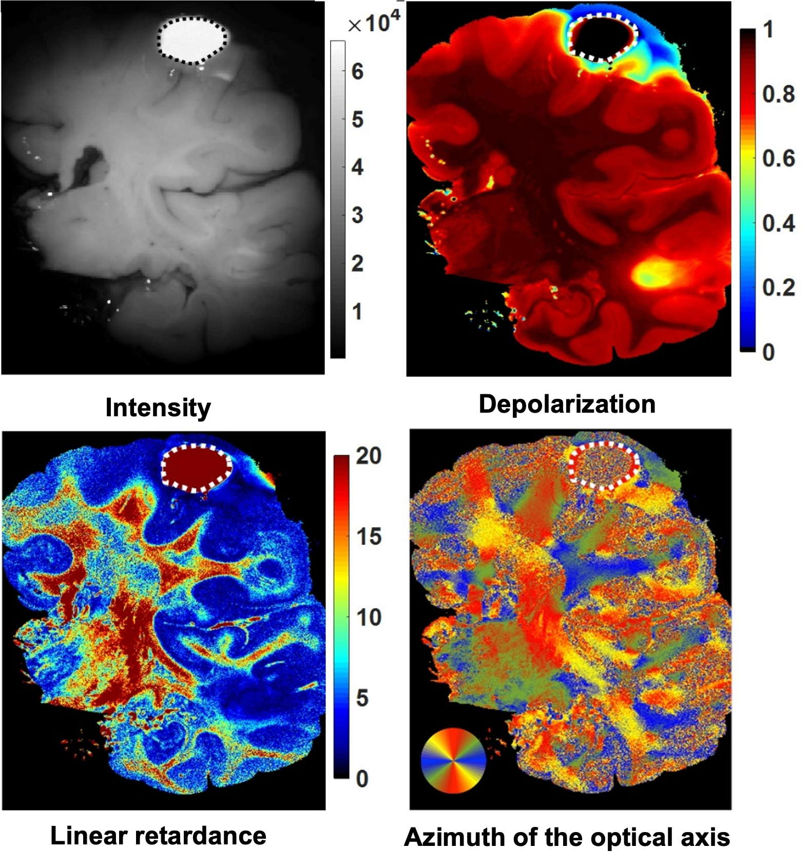 Seeing the Hidden Architecture of Brain White Matter