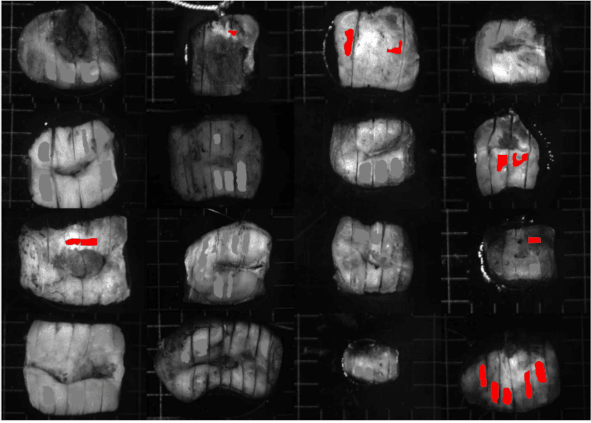 Early Detection of Uterine Cervix Pathologies
