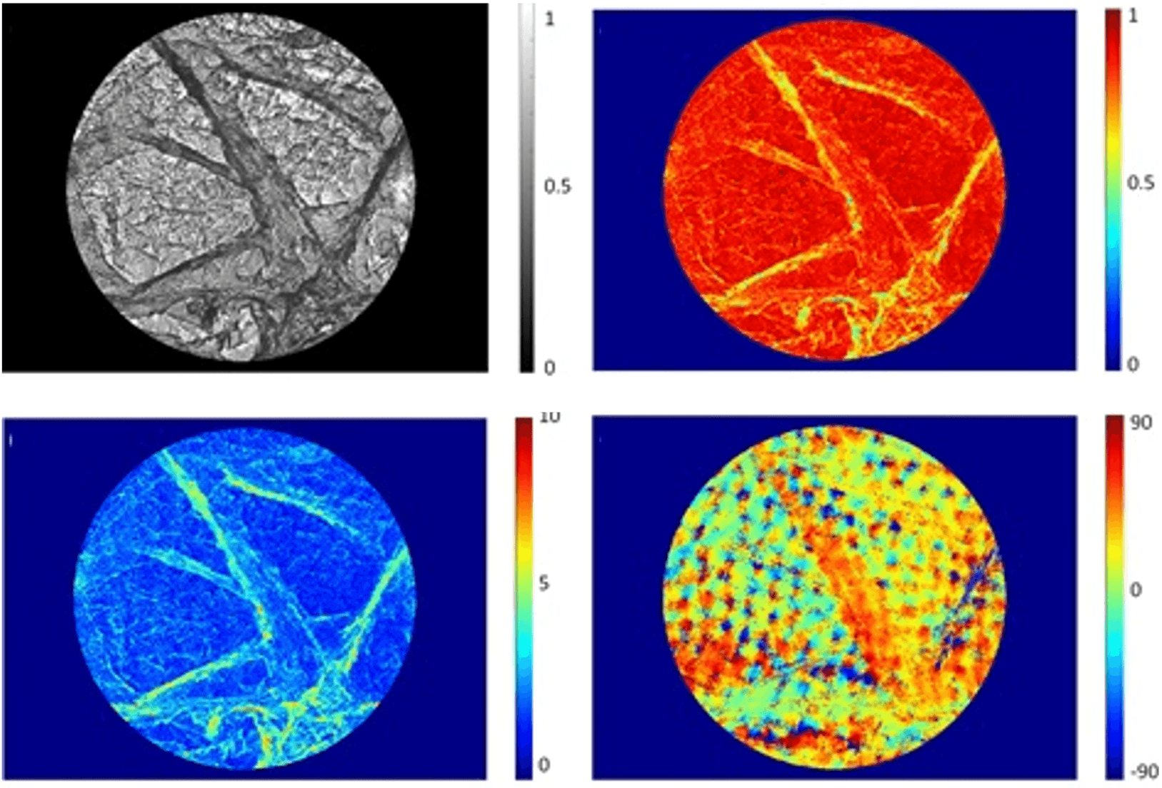 Skin Polarimetry
